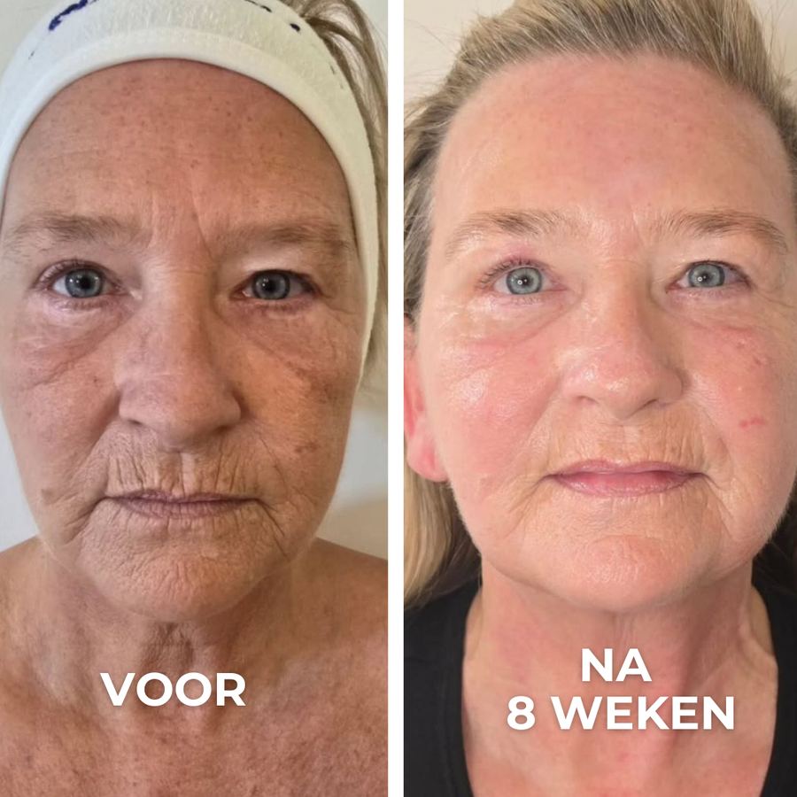 Stevigere wangen, zachtere lijntjes