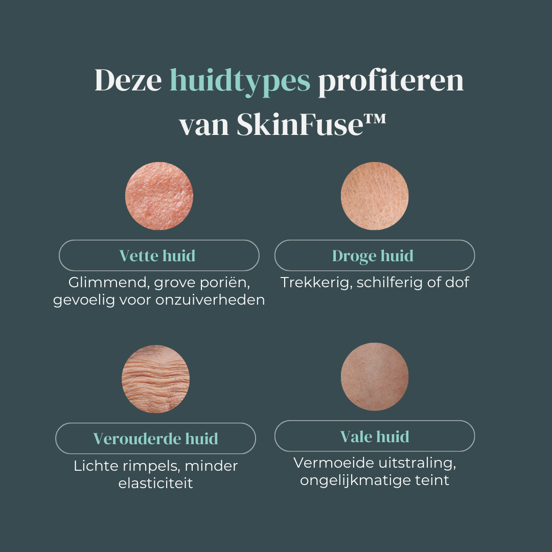 SkinFuse™ Micro-Infusion Kit 2.0